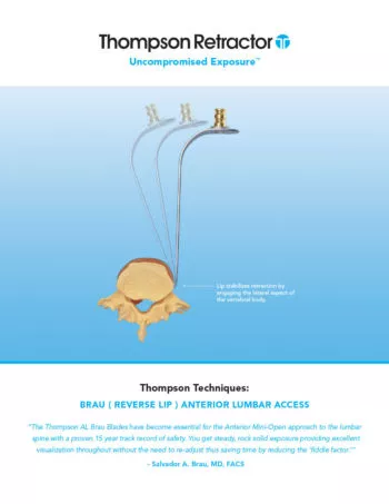 Thompson Surgical Instruments